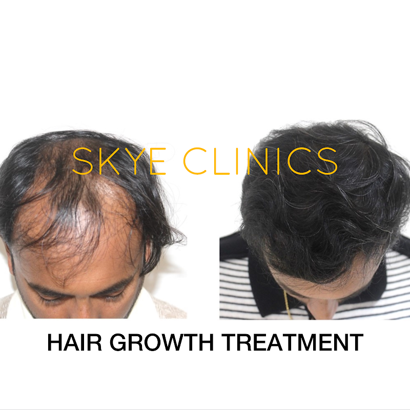 SKYE - Skin & Hair Sciences Clinics - SKYE - Skin & Hair Sciences Clinics 1st Floor, 116, 13th Main Rd, Sector 5, 1st Block Koramangala, HSR Layout, Bengaluru, Karnataka 560102, India