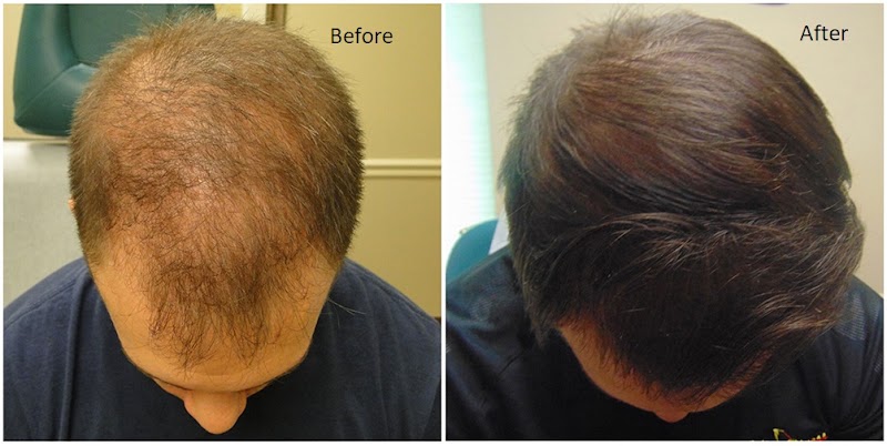 Arogya Clinic Skin and Hair clinic In Gurgaon PRP Treatment - Laser Treatment - Skin Specialist - Arogya Clinic Skin and Hair clinic In Gurgaon PRP Treatment - Laser Treatment - Skin Specialist opposite payal cinema, Prem Nagar, Rajiv Nagar, Sector 14, Gurugram, Haryana 122007, India