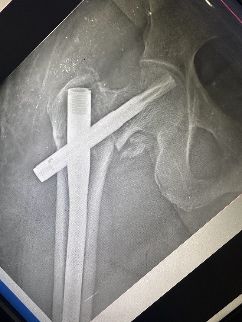 Dr Sumit Anand | Orthopedic Doctor | Surgeon, Joint Replacement Surgeon | Knee Replacement Surgeon in Sector 14 Gurgaon - Dr Sumit Anand | Orthopedic Doctor | Surgeon, Joint Replacement Surgeon | Knee Replacement Surgeon in Sector 14 Gurgaon Plot No. 1,2, Delhi Rd, Rajiv Nagar, Sector 14, Gurugram, Haryana 122007, India