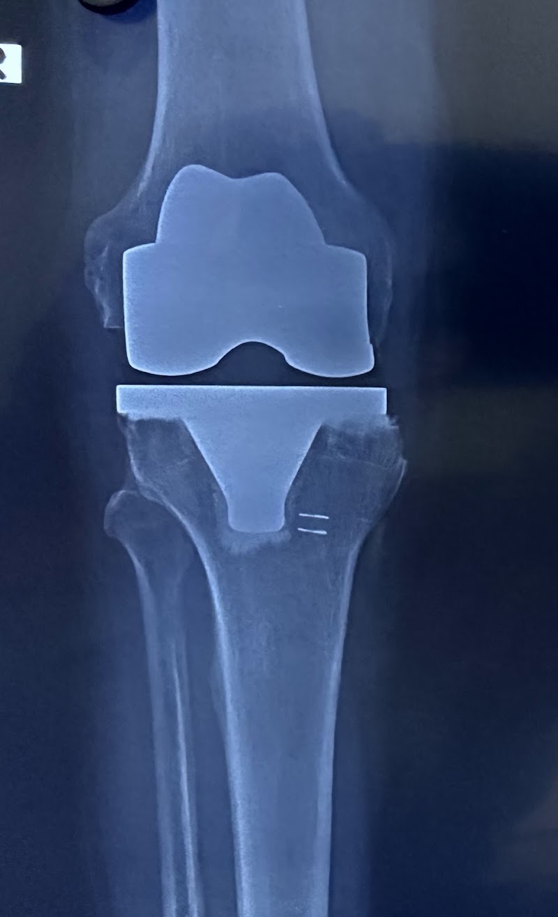 Dr Sumit Anand | Orthopedic Doctor | Surgeon, Joint Replacement Surgeon | Knee Replacement Surgeon in Sector 14 Gurgaon - Dr Sumit Anand | Orthopedic Doctor | Surgeon, Joint Replacement Surgeon | Knee Replacement Surgeon in Sector 14 Gurgaon Plot No. 1,2, Delhi Rd, Rajiv Nagar, Sector 14, Gurugram, Haryana 122007, India