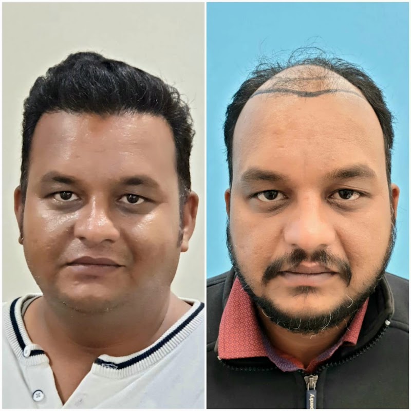 Dr Prakash Khute, MD (AIIMS, New Delhi)- Best skin specialist in Raipur| Dermatologist| Hair transplant| Lasers| PRP - Dr Prakash Khute, MD (AIIMS, New Delhi)- Best skin specialist in Raipur| Dermatologist| Hair transplant| Lasers| PRP, 25th avenue, near Lotus electronic store, Sector 1, Shankar Nagar, Raipur, Chhattisgarh 492004, India