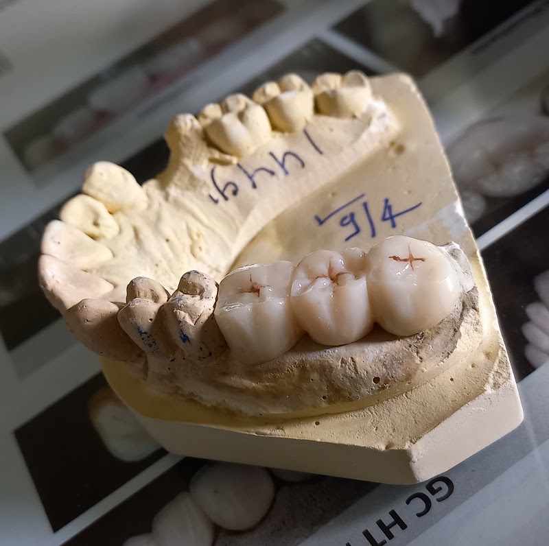 JN Dental Clinic - JN Dental Clinic, J.N.DENTAL CURE & CARE, MADHYANAGRI CHOWK, near RADHAKRISHNA MANDIR, Juni Line, Bilaspur, Gol Bazar, Chhattisgarh 495001, India
