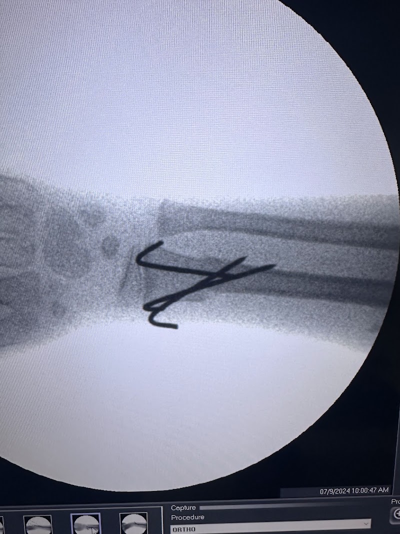 Dr Sumit Anand | Orthopedic Doctor | Surgeon, Joint Replacement Surgeon | Knee Replacement Surgeon in Sector 14 Gurgaon - Dr Sumit Anand | Orthopedic Doctor | Surgeon, Joint Replacement Surgeon | Knee Replacement Surgeon in Sector 14 Gurgaon Plot No. 1,2, Delhi Rd, Rajiv Nagar, Sector 14, Gurugram, Haryana 122007, India