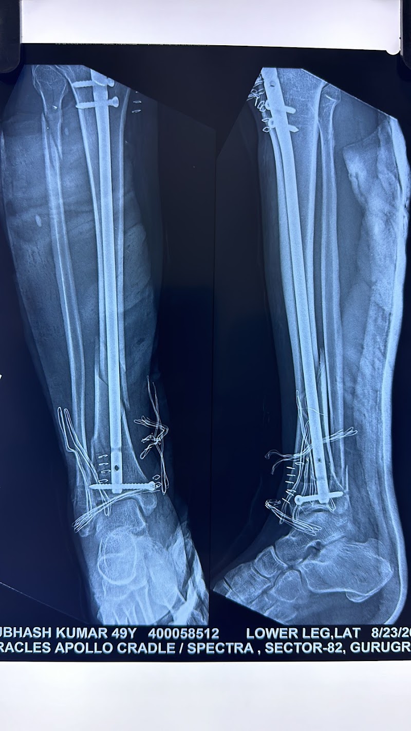 Dr Sumit Anand | Orthopedic Doctor | Surgeon, Joint Replacement Surgeon | Knee Replacement Surgeon in Sector 14 Gurgaon - Dr Sumit Anand | Orthopedic Doctor | Surgeon, Joint Replacement Surgeon | Knee Replacement Surgeon in Sector 14 Gurgaon Plot No. 1,2, Delhi Rd, Rajiv Nagar, Sector 14, Gurugram, Haryana 122007, India