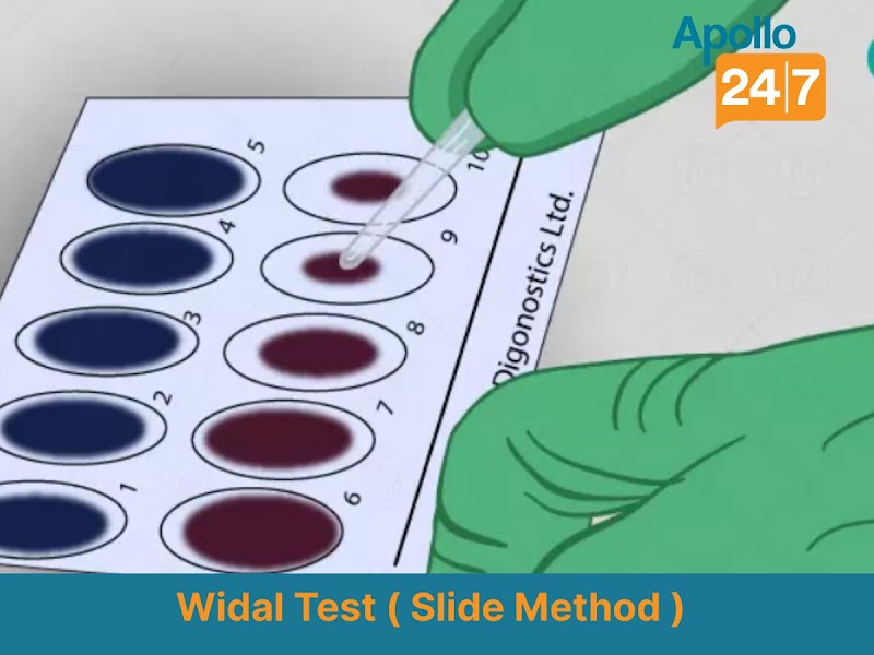 Apollo 24|7 Lab Test Near Me | Baloda Bazar | Home Collection | Raipur - Apollo 24|7 Lab Test Near Me | Baloda Bazar | Home Collection | Raipur, Main Rd, Raipur, Baloda Bazar, Chhattisgarh 493332, India
