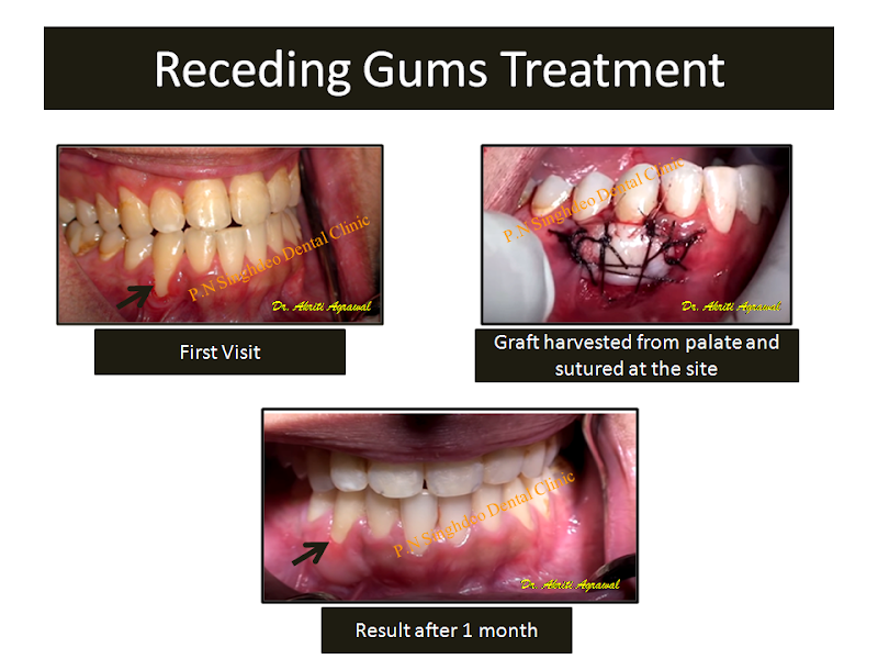 P.N SINGHDEO DENTAL CLINIC - P.N SINGHDEO DENTAL CLINIC, behind Durga mandap, Govindtola, Gopal Bihar, Sambalpur, Odisha 768005, India