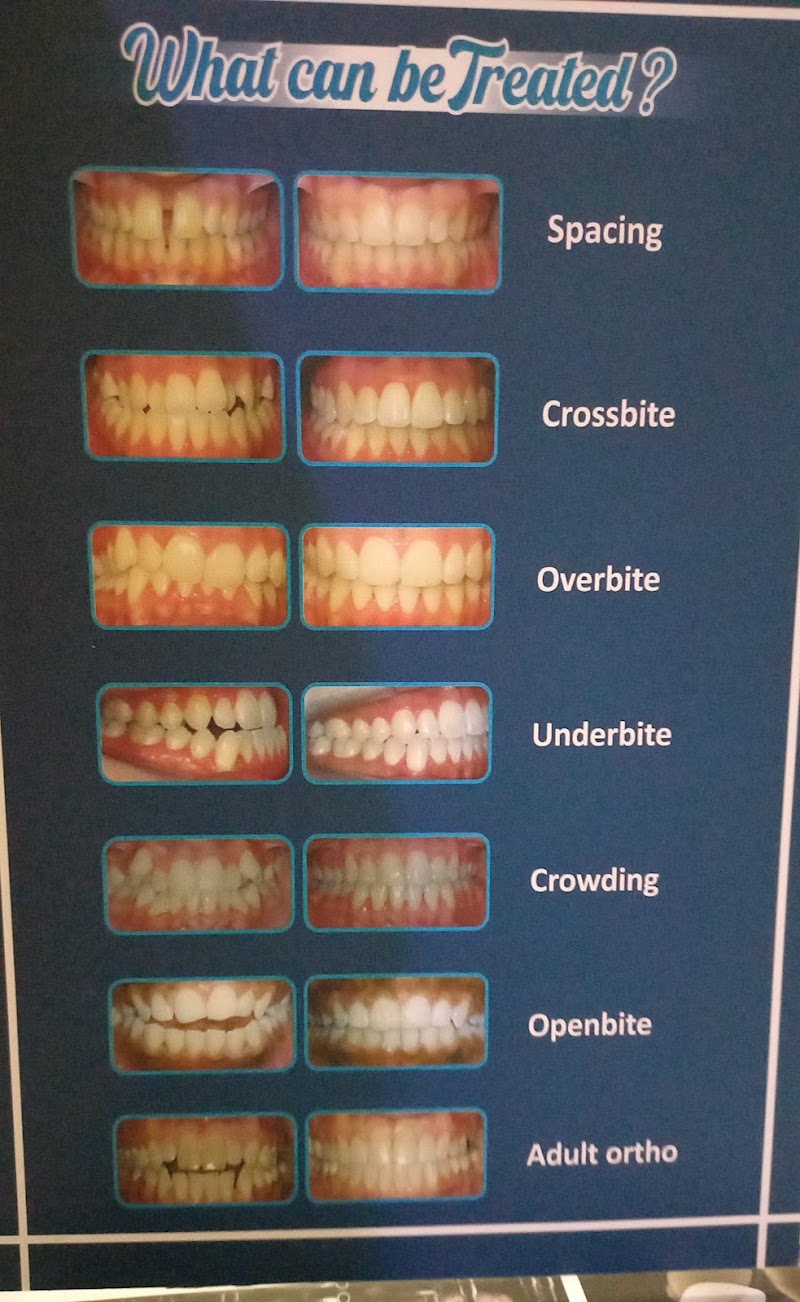 JN Dental Clinic - JN Dental Clinic, J.N.DENTAL CURE & CARE, MADHYANAGRI CHOWK, near RADHAKRISHNA MANDIR, Juni Line, Bilaspur, Gol Bazar, Chhattisgarh 495001, India