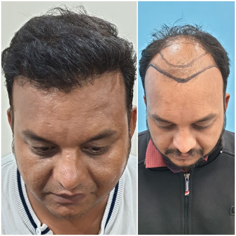 Dr Prakash Khute, MD (AIIMS, New Delhi)- Best skin specialist in Raipur| Dermatologist| Hair transplant| Lasers| PRP - Dr Prakash Khute, MD (AIIMS, New Delhi)- Best skin specialist in Raipur| Dermatologist| Hair transplant| Lasers| PRP, 25th avenue, near Lotus electronic store, Sector 1, Shankar Nagar, Raipur, Chhattisgarh 492004, India