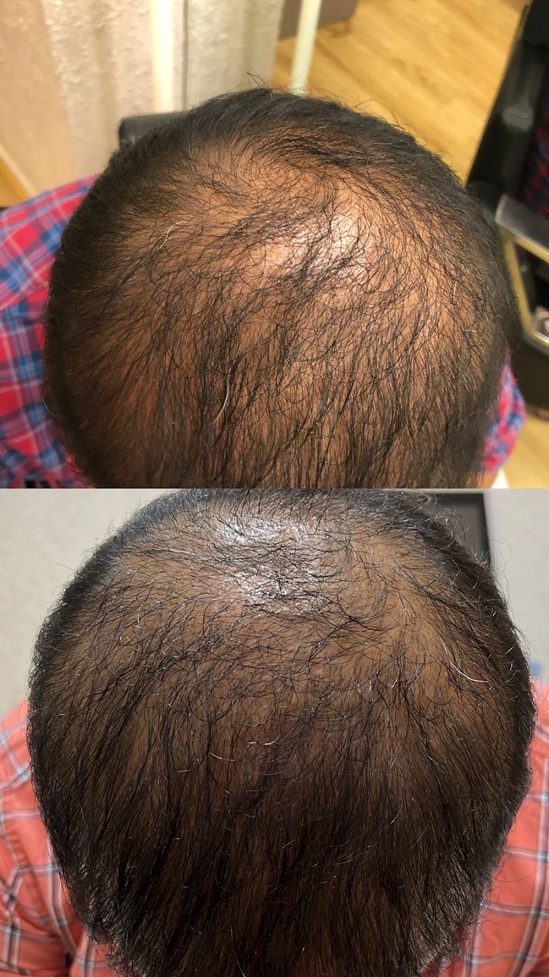Dermatonik Aesthetic clinic HSR Layout - Dermatonik Aesthetic clinic HSR Layout 1655, 27th Main Rd, opp. Nift College, Parangi Palaya, 1st Sector, HSR Layout, Bengaluru, Karnataka 560102, India