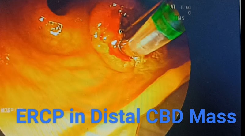 Dr. Ashish Chand Dewangan | Best Gastroenterologist in Bhilai - Durg - Dr. Ashish Chand Dewangan | Best Gastroenterologist in Bhilai - Durg, Ambey Medical Stores, in front of Mennonite Chruch, Pendarvani, Durg, Chhattisgarh 491001, India