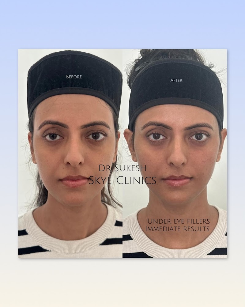 SKYE - Skin & Hair Sciences Clinics - SKYE - Skin & Hair Sciences Clinics 1st Floor, 116, 13th Main Rd, Sector 5, 1st Block Koramangala, HSR Layout, Bengaluru, Karnataka 560102, India