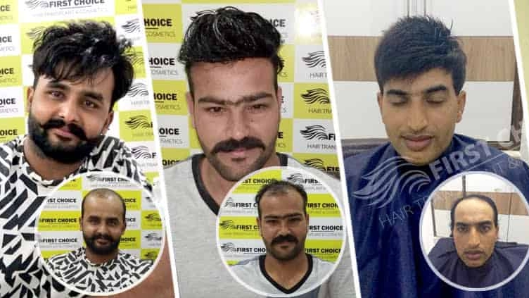 Niyaz hair solution Best Wig Dealer In Durg Bhilai - Niyaz hair solution Best Wig Dealer In Durg Bhilai, Janta market, GE Rd, power house, Camp 2, Bhilai, Chhattisgarh 490001, India