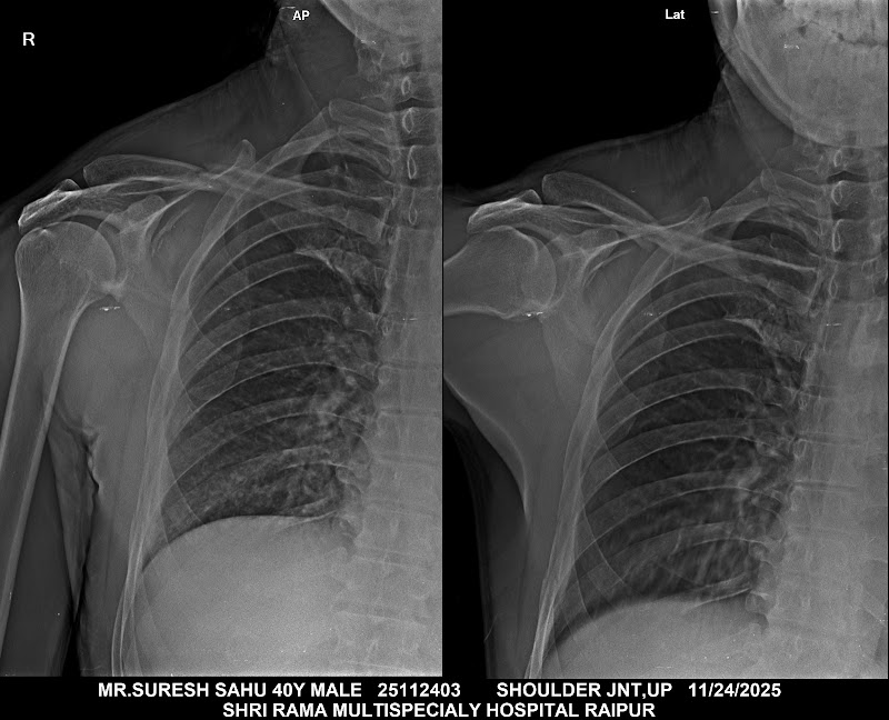 Dr. Abhishek Jain - Dr. Abhishek Jain, Bone And Baby Clinic, near Radio Mirchi, Bottle House, in front of royal homes, Geetanjali Colony, Shankar Nagar, Raipur, Chhattisgarh 492001, India