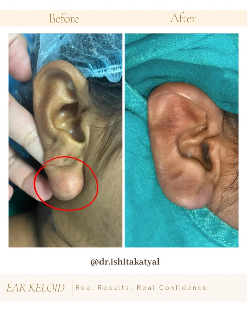 Dr. Ishita Katyal: Plastic, Reconstructive and cosmetic Surgeon In Raipur - Dr. Ishita Katyal: Plastic, Reconstructive and cosmetic Surgeon In Raipur, Pachpedi Naka Rd, beside Colours Mall, Amrapali Society, Gurumukh Singh Nagar, Raipur, Tikrapara, Chhattisgarh 492001, India