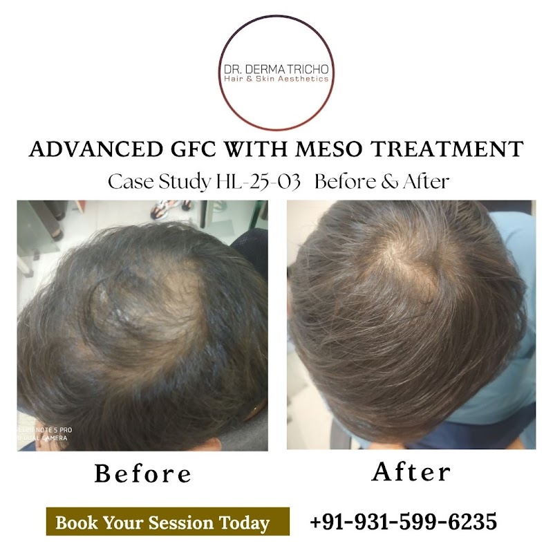 Dr. Derma Tricho Hair & Skin Aesthetics - Dr. Derma Tricho Hair & Skin Aesthetics M13, Block B, Old DLF Colony, Sector 14, Gurugram, Haryana 122001, India