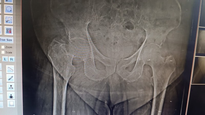 Dr. Abhishek Jain - Dr. Abhishek Jain, Bone And Baby Clinic, near Radio Mirchi, Bottle House, in front of royal homes, Geetanjali Colony, Shankar Nagar, Raipur, Chhattisgarh 492001, India