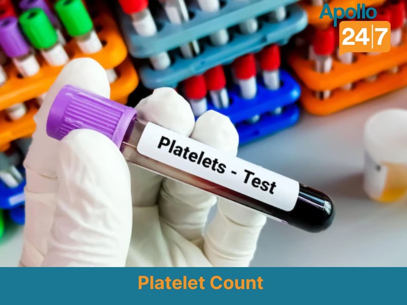 Apollo 24|7 Lab Test Near Me | Baloda Bazar | Home Collection | Raipur - Apollo 24|7 Lab Test Near Me | Baloda Bazar | Home Collection | Raipur, Main Rd, Raipur, Baloda Bazar, Chhattisgarh 493332, India