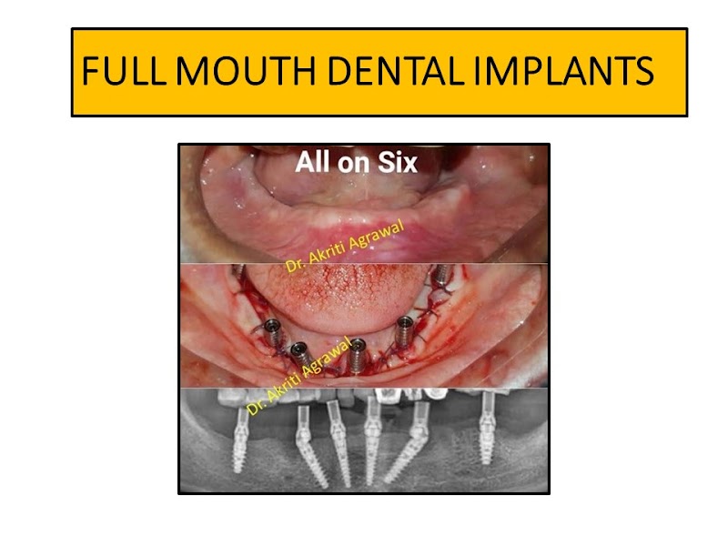 P.N SINGHDEO DENTAL CLINIC - P.N SINGHDEO DENTAL CLINIC, behind Durga mandap, Govindtola, Gopal Bihar, Sambalpur, Odisha 768005, India