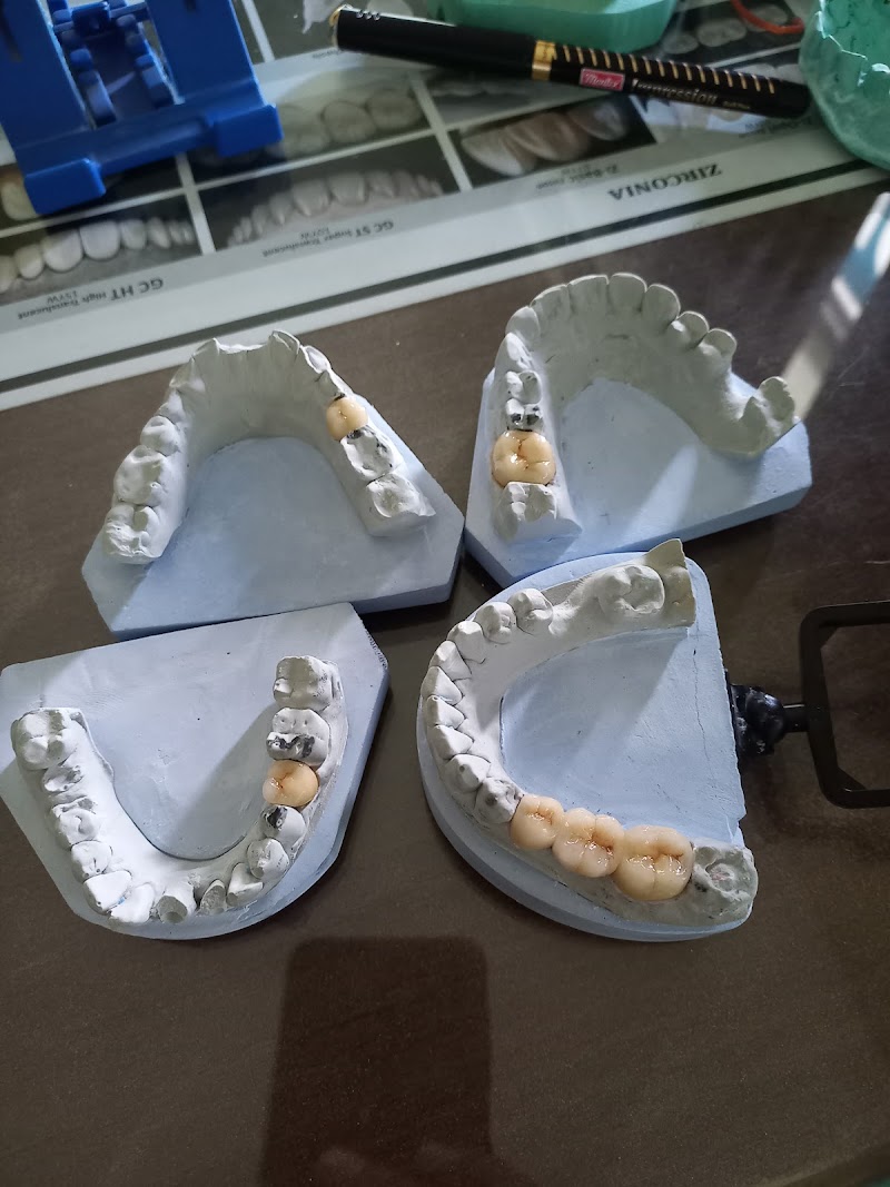 JN Dental Clinic - JN Dental Clinic, J.N.DENTAL CURE & CARE, MADHYANAGRI CHOWK, near RADHAKRISHNA MANDIR, Juni Line, Bilaspur, Gol Bazar, Chhattisgarh 495001, India