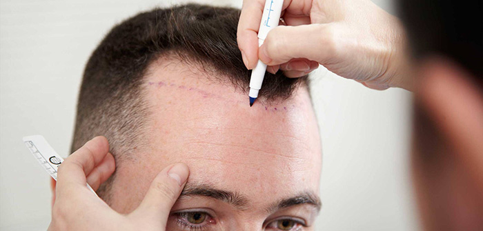Dr Prakash Khute, MD (AIIMS, New Delhi)- Best skin specialist in Raipur| Dermatologist| Hair transplant| Lasers| PRP - Dr Prakash Khute, MD (AIIMS, New Delhi)- Best skin specialist in Raipur| Dermatologist| Hair transplant| Lasers| PRP, 25th avenue, near Lotus electronic store, Sector 1, Shankar Nagar, Raipur, Chhattisgarh 492004, India