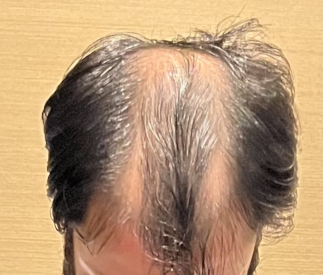Delight Clinic - Delight Clinic Shop No. 59, 1st Floor, Main, Jharsa Road, Old Delhi Gurugram Rd, Kirti Nagar, Sector 15 Part 2, Patel Nagar, Gurugram, Haryana 122001, India