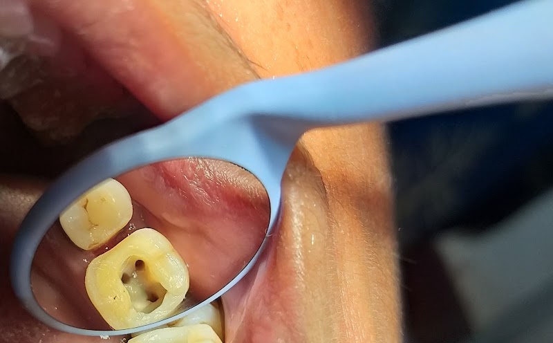 We Care Dental Clinic Dr Anil Ku Sahu - We Care Dental Clinic Dr Anil Ku Sahu, 1st floor,Hotel Atithi Vihar,Bheunria, chowk, Padmapur, Padmapur Town, Odisha 768036, India