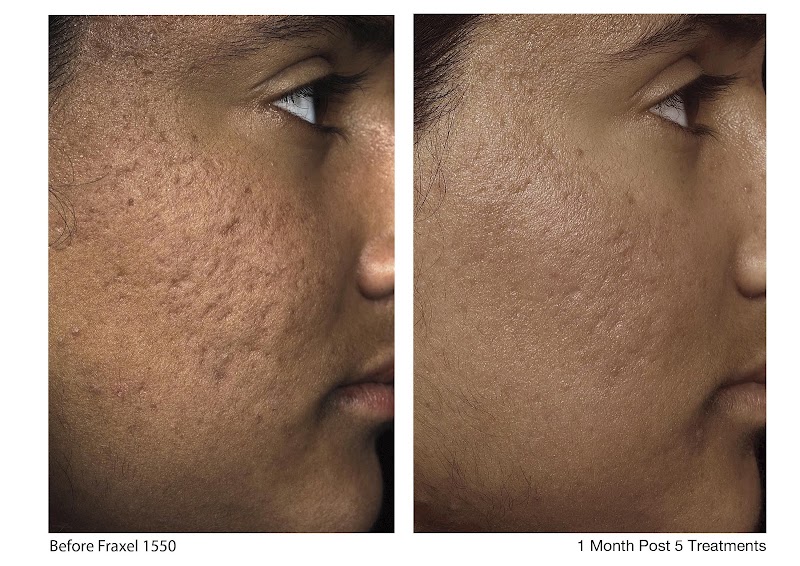 Arogya Clinic Skin and Hair clinic In Gurgaon PRP Treatment - Laser Treatment - Skin Specialist - Arogya Clinic Skin and Hair clinic In Gurgaon PRP Treatment - Laser Treatment - Skin Specialist opposite payal cinema, Prem Nagar, Rajiv Nagar, Sector 14, Gurugram, Haryana 122007, India