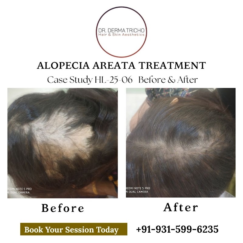 Dr. Derma Tricho Hair & Skin Aesthetics - Dr. Derma Tricho Hair & Skin Aesthetics M13, Block B, Old DLF Colony, Sector 14, Gurugram, Haryana 122001, India