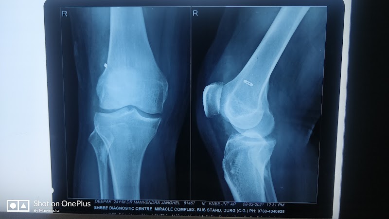 DR MANVENDRA JANGHEL BONE, JOINT & ARTHRITIS CLINIC - DR MANVENDRA JANGHEL BONE, JOINT & ARTHRITIS CLINIC, Shop No-26, Housing board complex, New Bus Stand, Pendarvani, Durg, Chhattisgarh 491001, India