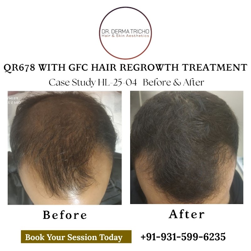 Dr. Derma Tricho Hair & Skin Aesthetics - Dr. Derma Tricho Hair & Skin Aesthetics M13, Block B, Old DLF Colony, Sector 14, Gurugram, Haryana 122001, India