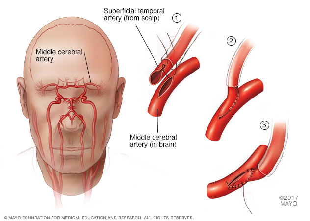 Dr Medha Vyas - Best Neurosurgeon in South Bombay - Dr Medha Vyas - Best Neurosurgeon in South Bombay Block 1, G-5, Tardeo Rd, Old Chikalwadi, Grant Road (W), Tardeo, Mumbai, Maharashtra 400007, India