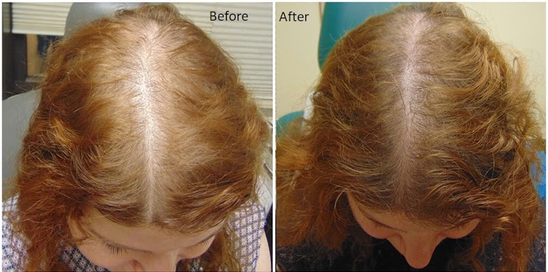 Arogya Clinic Skin and Hair clinic In Gurgaon PRP Treatment - Laser Treatment - Skin Specialist - Arogya Clinic Skin and Hair clinic In Gurgaon PRP Treatment - Laser Treatment - Skin Specialist opposite payal cinema, Prem Nagar, Rajiv Nagar, Sector 14, Gurugram, Haryana 122007, India