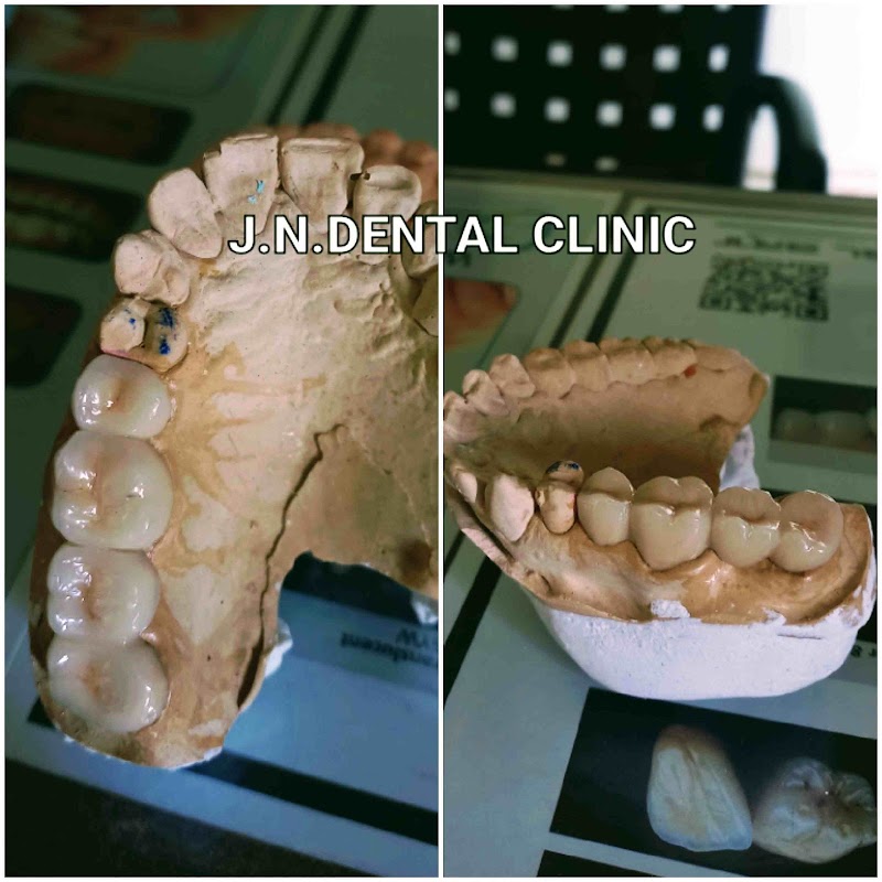 JN Dental Clinic - JN Dental Clinic, J.N.DENTAL CURE & CARE, MADHYANAGRI CHOWK, near RADHAKRISHNA MANDIR, Juni Line, Bilaspur, Gol Bazar, Chhattisgarh 495001, India