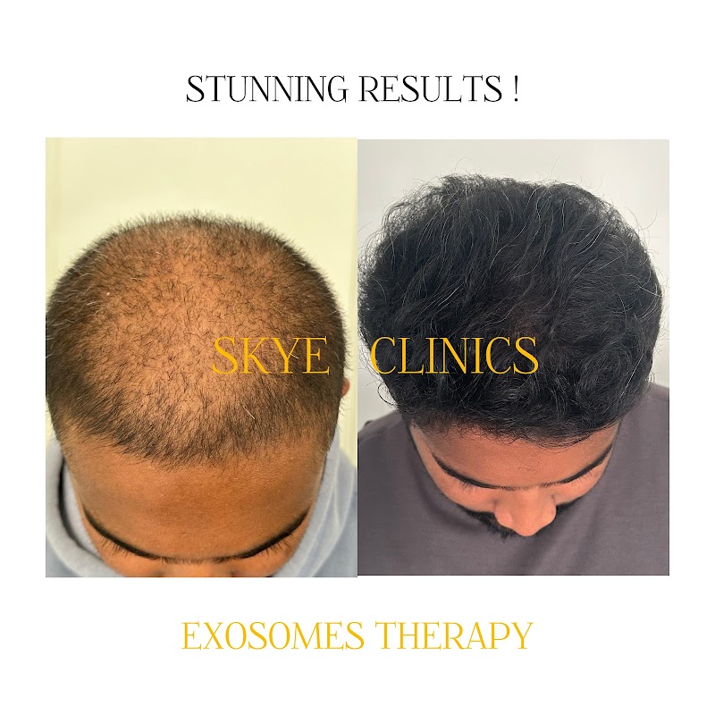 SKYE - Skin & Hair Sciences Clinics - SKYE - Skin & Hair Sciences Clinics 1st Floor, 116, 13th Main Rd, Sector 5, 1st Block Koramangala, HSR Layout, Bengaluru, Karnataka 560102, India