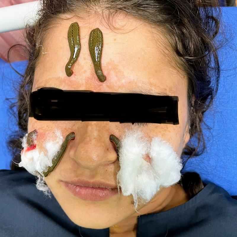 Arogya Clinic Skin and Hair clinic In Gurgaon PRP Treatment - Laser Treatment - Skin Specialist - Arogya Clinic Skin and Hair clinic In Gurgaon PRP Treatment - Laser Treatment - Skin Specialist opposite payal cinema, Prem Nagar, Rajiv Nagar, Sector 14, Gurugram, Haryana 122007, India